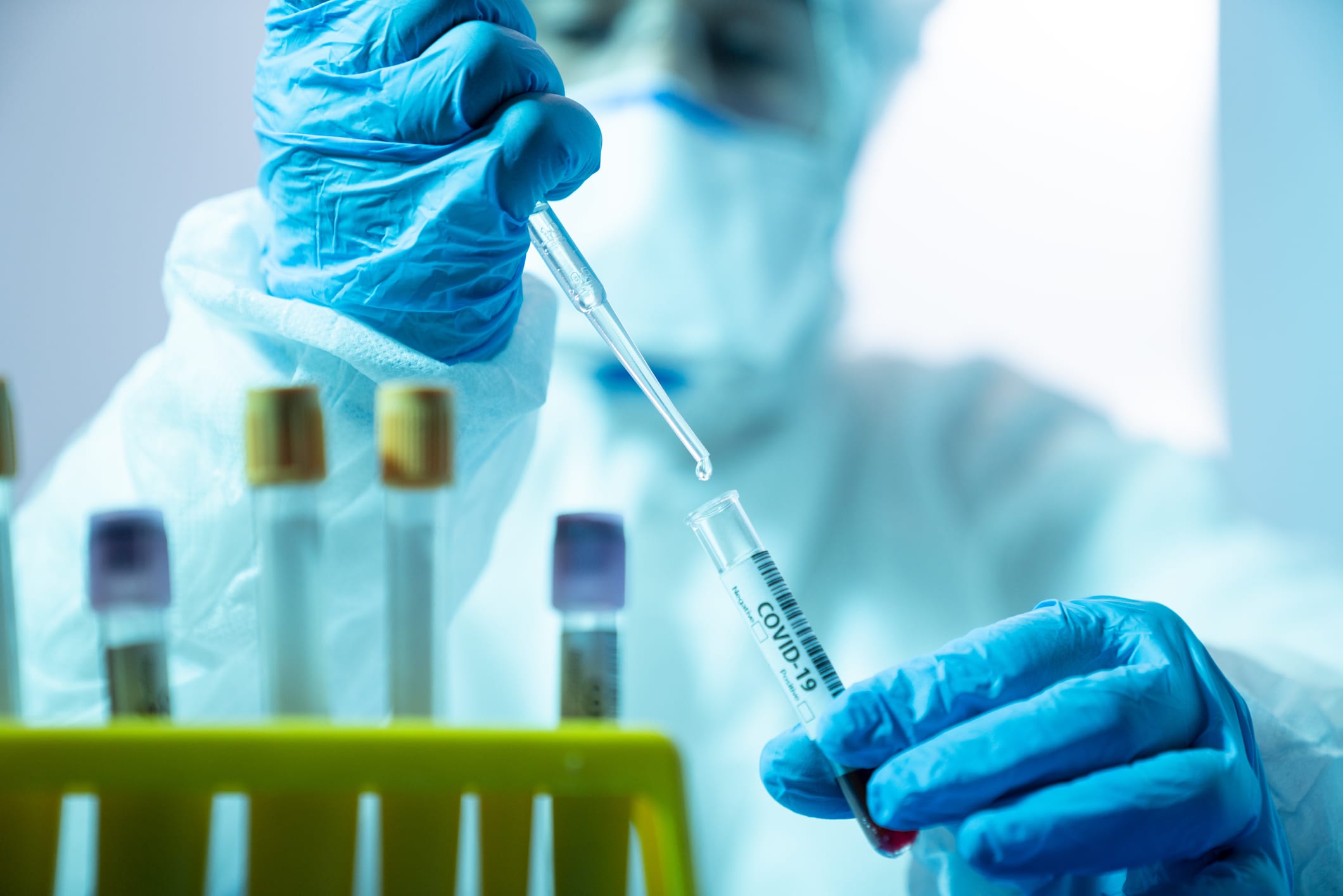 Scientist Woman Working In The CDC Laboratory For Covid-19