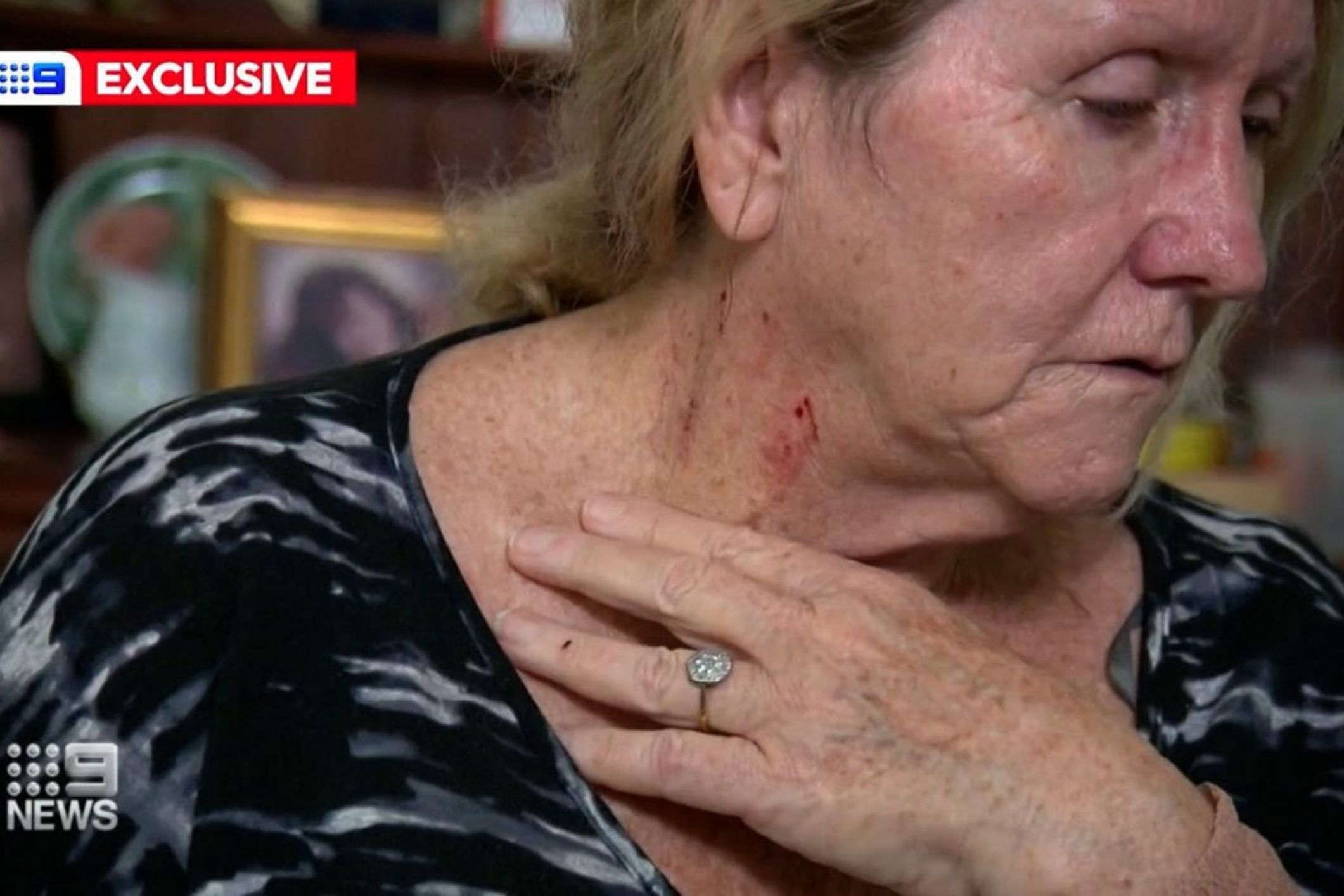 Grandma attacked getting COVID test