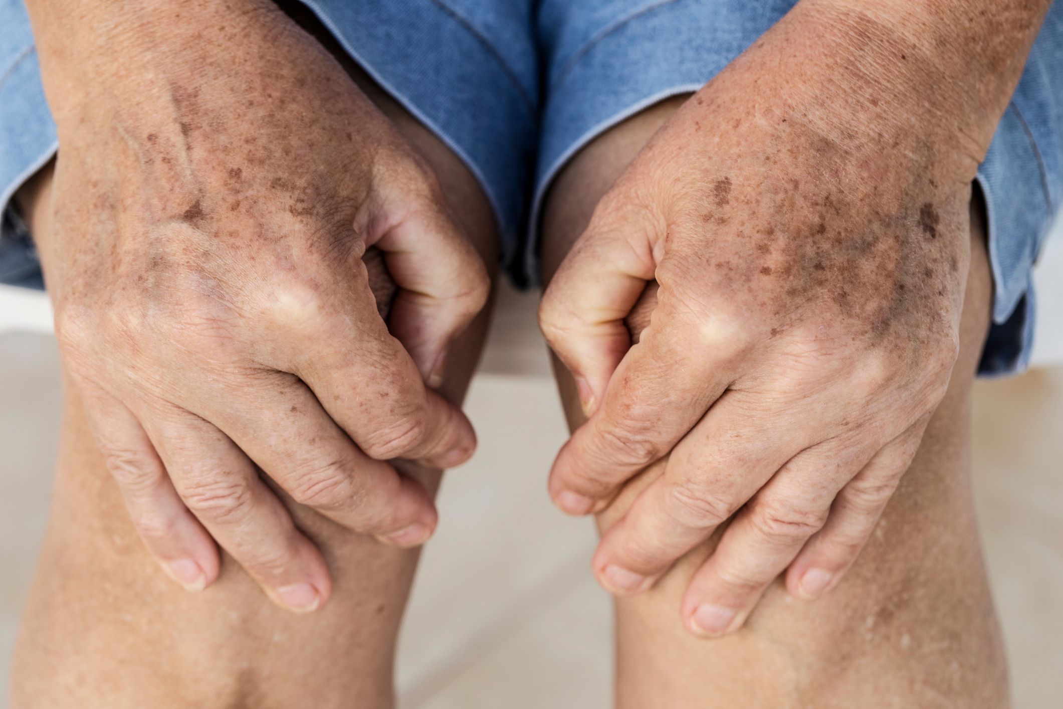 What Does it Mean When Your Knees Creak?