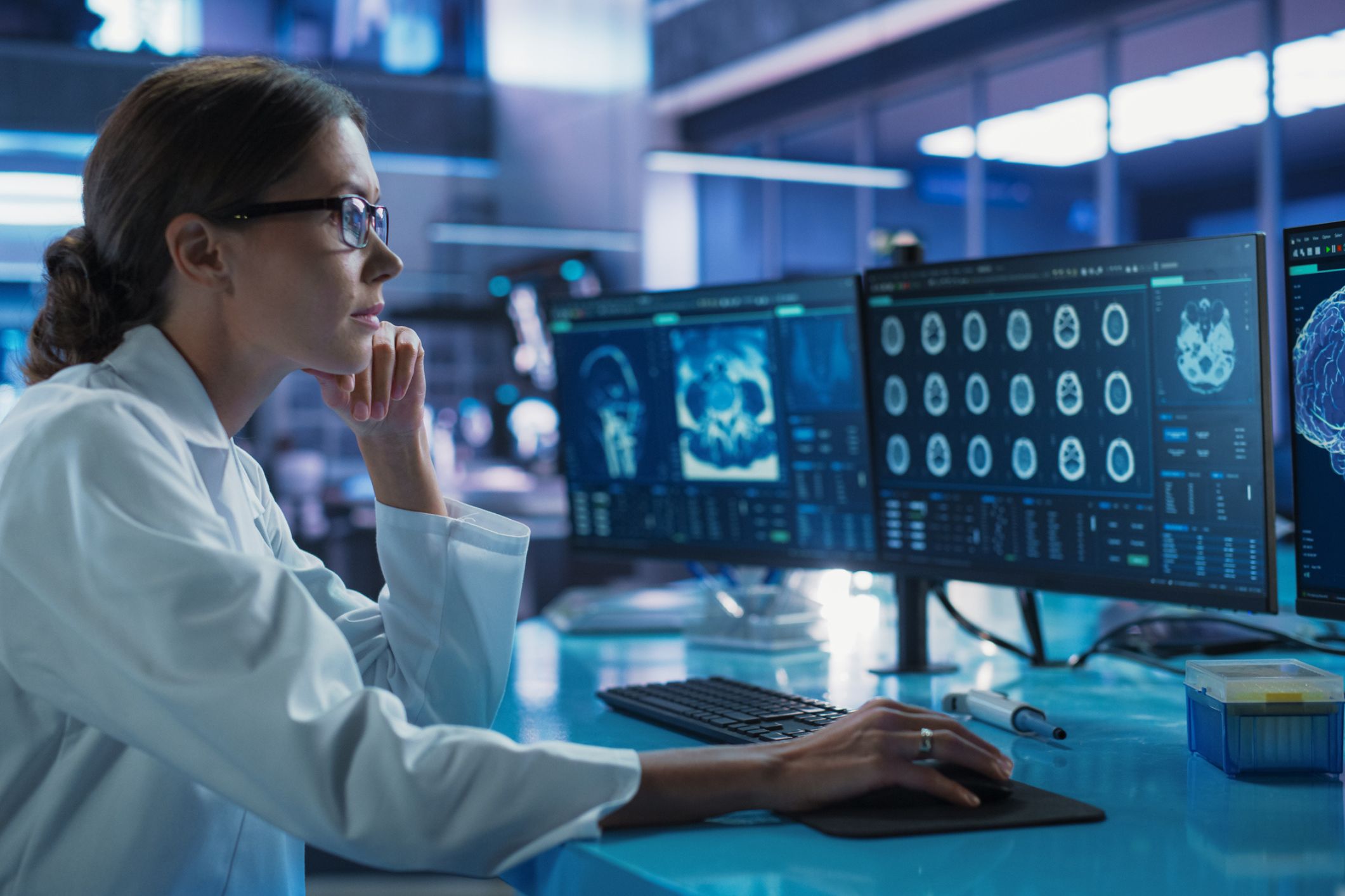 Early-onset Alzheimer’s: new drug shows promise in slowing the disease