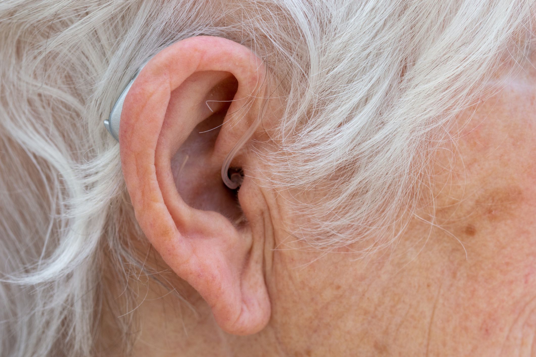 Gene therapy breakthrough restores hearing in kids and adults