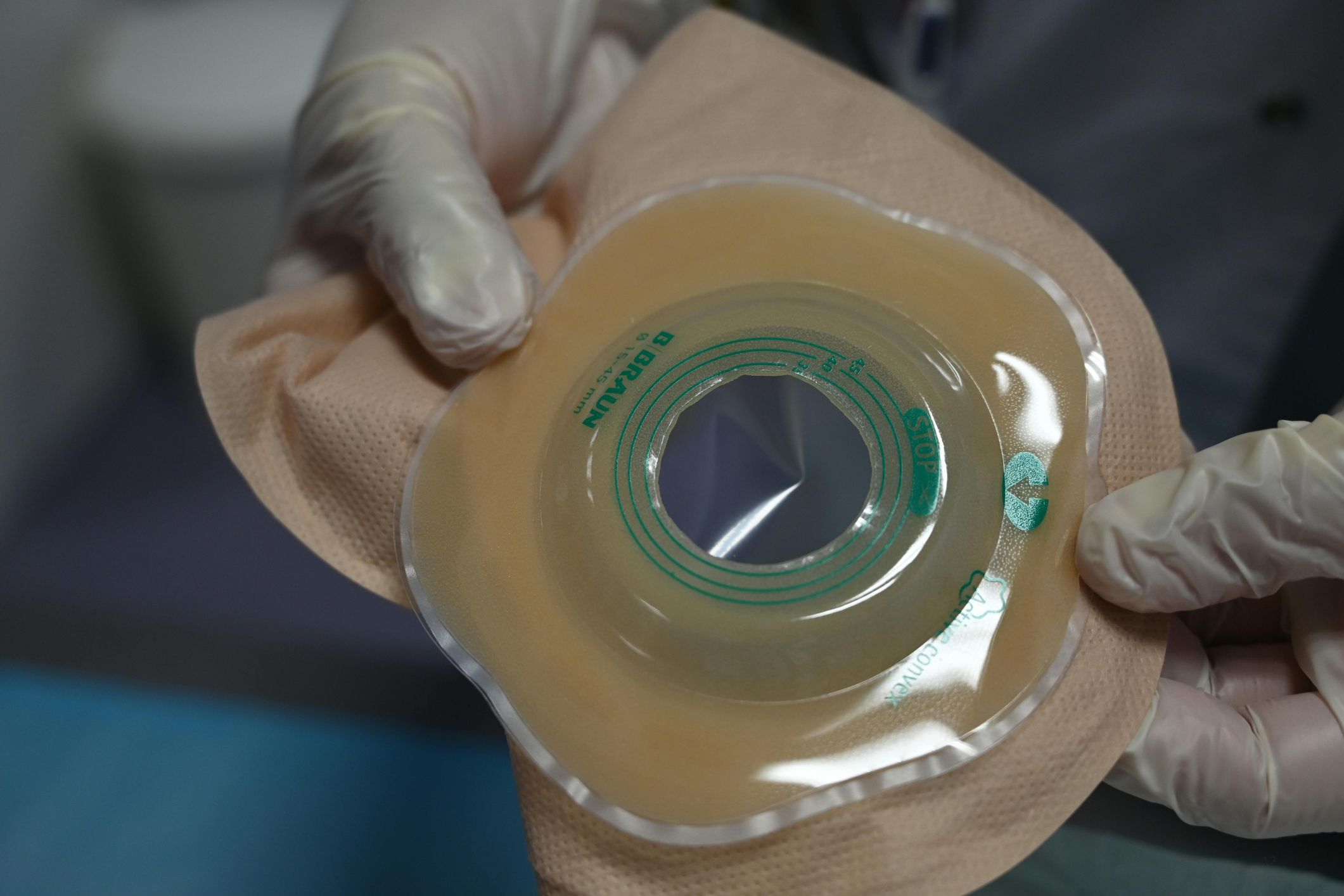 Should colostomy bag changes be limited to nurses in aged care?