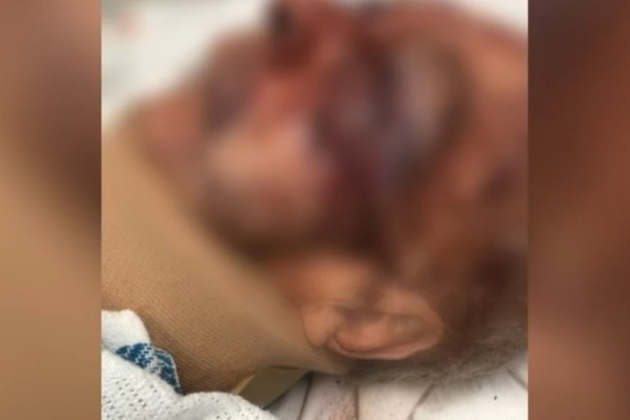 Police charge aged care resident following horrific violent assault on fellow resident